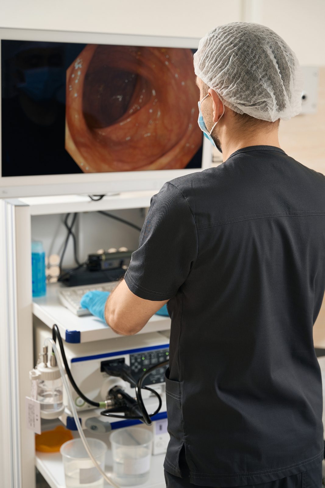 Ultrasonido endoscópico digestivo realizado por especialistas en Endogastro Costa Rica